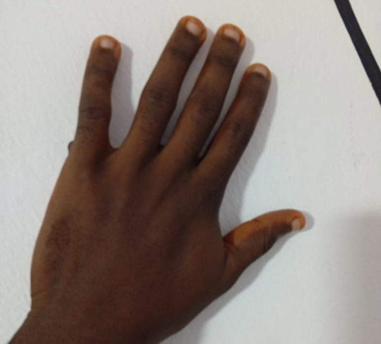 Read more about the article Tadese Faforiji – The Parts of Me I Learned to Hide, Read Only If You are Ugly